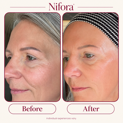 Nifora source customer before-and-after comparison; individual experiences vary